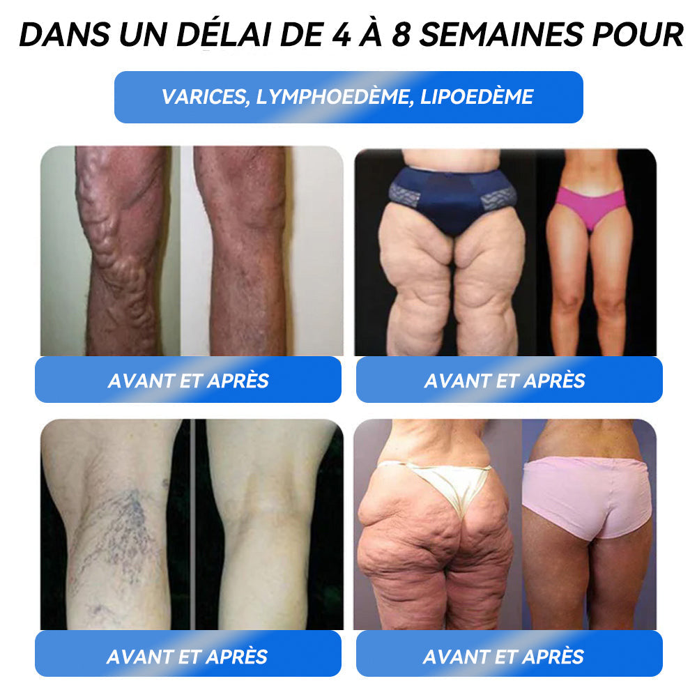𝐈𝐅𝐌𝐀𝐆𝐈𝐂® 𝐆𝐋𝐏-𝟏 𝐏𝐫𝐨 𝐒𝐨𝐥𝐮𝐭𝐢𝐨𝐧 𝐨𝐫𝐚𝐥𝐞 𝐩𝐨𝐮𝐫 𝐥𝐚 𝐩𝐞𝐫𝐭𝐞 𝐝𝐞 𝐩𝐨𝐢𝐝𝐬💄💄Une dose par jour — voyez les résultats en 7 jours⏱️