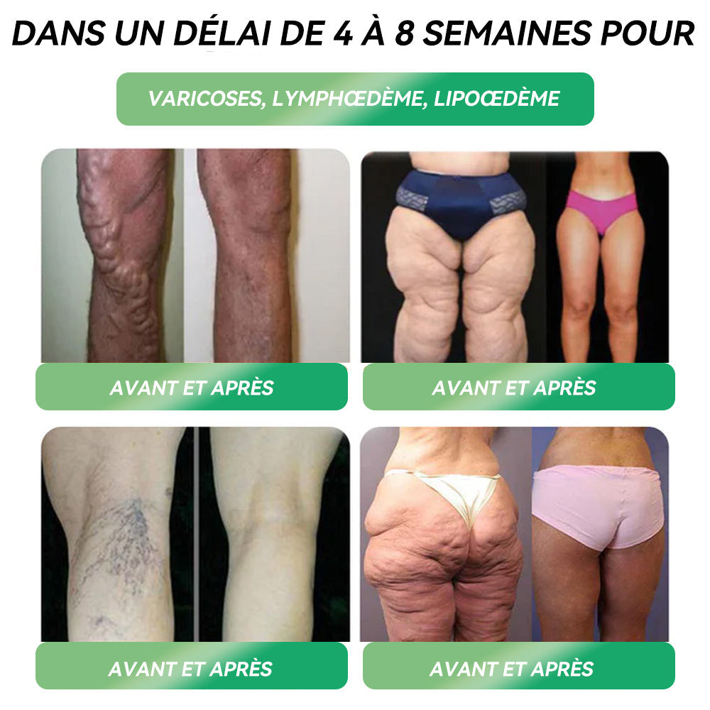 𝑆𝑇𝐷𝐸𝐼® 𝐺𝐿𝑃-1 𝑃𝑜𝑖𝑑𝑠 𝑃𝑒𝑟𝑡𝑒 𝑂𝑟𝑎𝑙 𝑆𝑜𝑙𝑢𝑡𝑖𝑜𝑛📗📗Une dose par jour — voyez les résultats en 7 jours⏱️